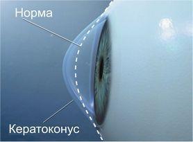 Фотография Глазная Клиника Доктора Яковлева 1