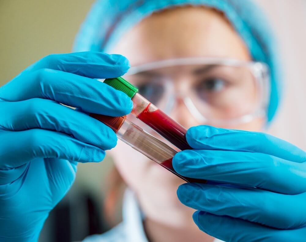 На какие гормоны сдают анализ крови?